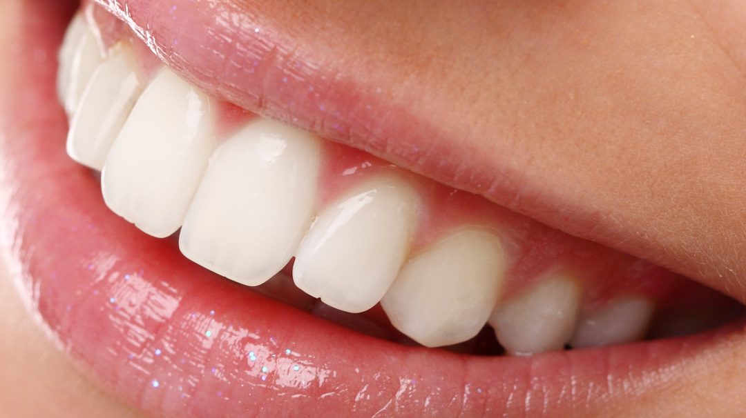 6 Consejos para tener los dientes blancos